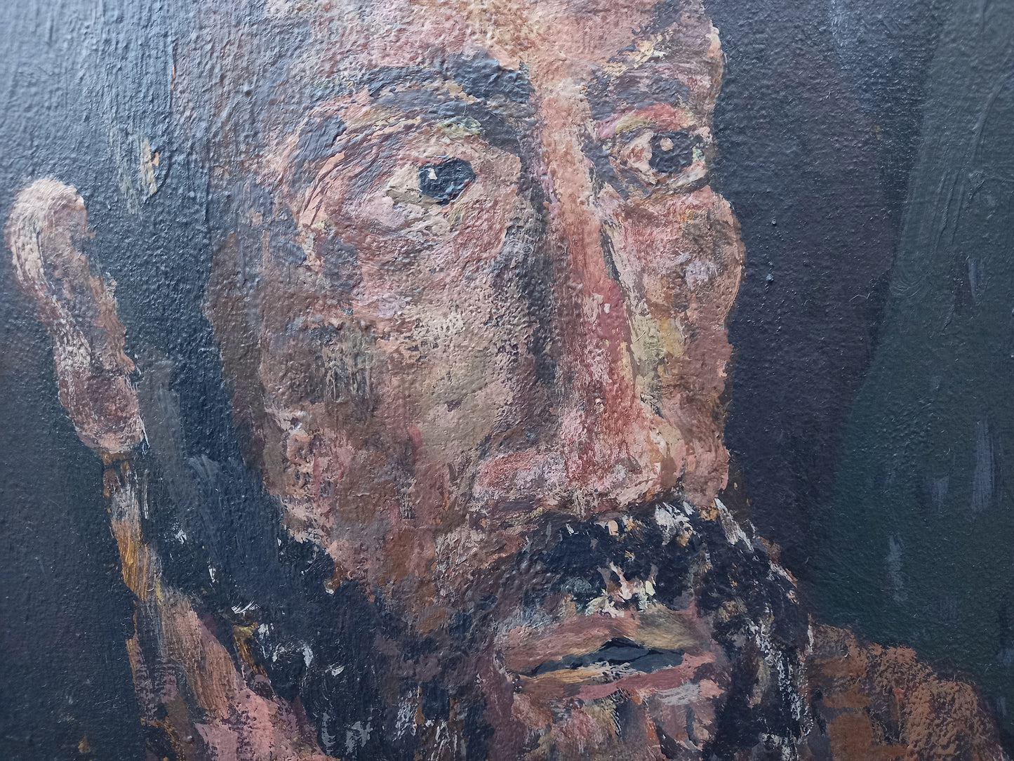 The Hands of Lazarus (2010)